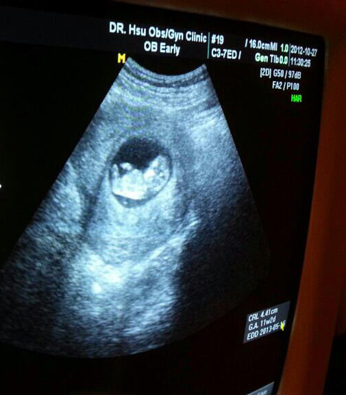 懷孕初期症狀,懷孕三個月,懷孕初期,懷孕徵兆